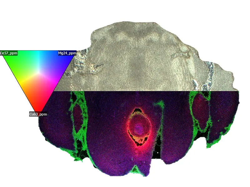 LA-ICP-TOFMS Image of a Mouse Brain LA-ICP-TOFMS Image of a Mouse Brain