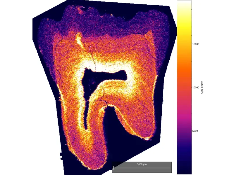 Human Tooth - Single element distribution within a
human molar tooth using imageGEO193 - Barium Ba138